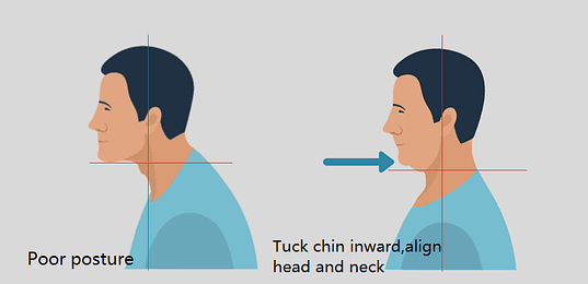 chin tuck exercise